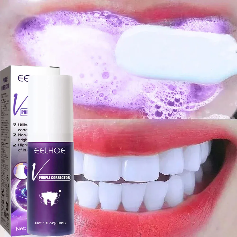 Teeth Whitening Opalescence - Teeth Whitening Toothpaste Remove Plaque Stains