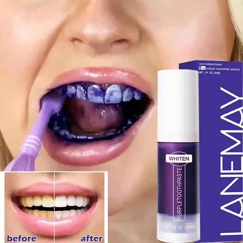 V34 Purple Teeth Whitening Too - Teeth Whitening Opalescence ulasan dan harga