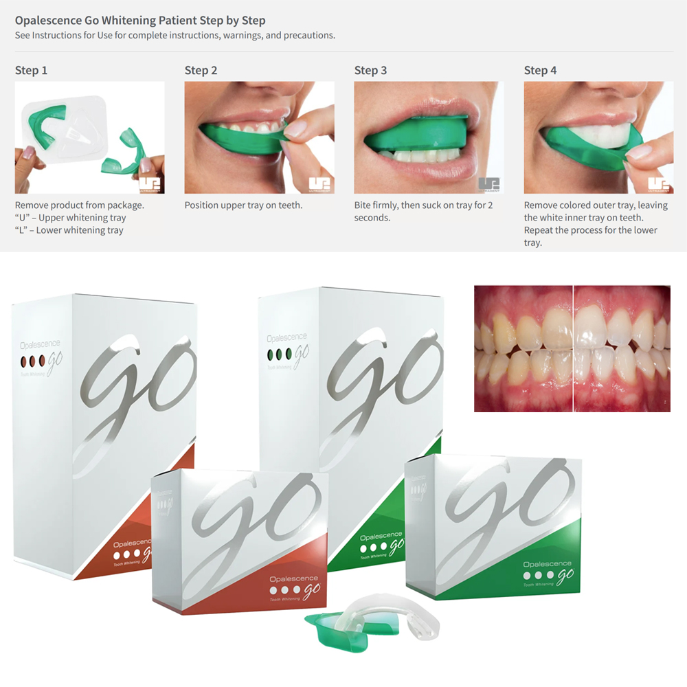 Opalescence Go Teeth Whitening - Teeth Whitening Opalescence ulasan dan harga
