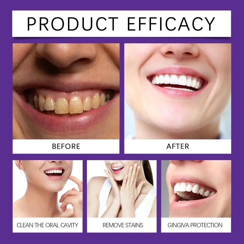 Purple Teeth Restoration Miner - Teeth Whitening At Home ulasan dan harga