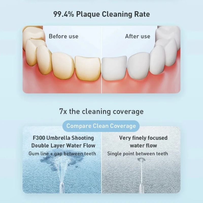 Mijia Oral Irrigator F300 Dent - Teeth Whitening Or Tooth Whitening ulasan dan harga
