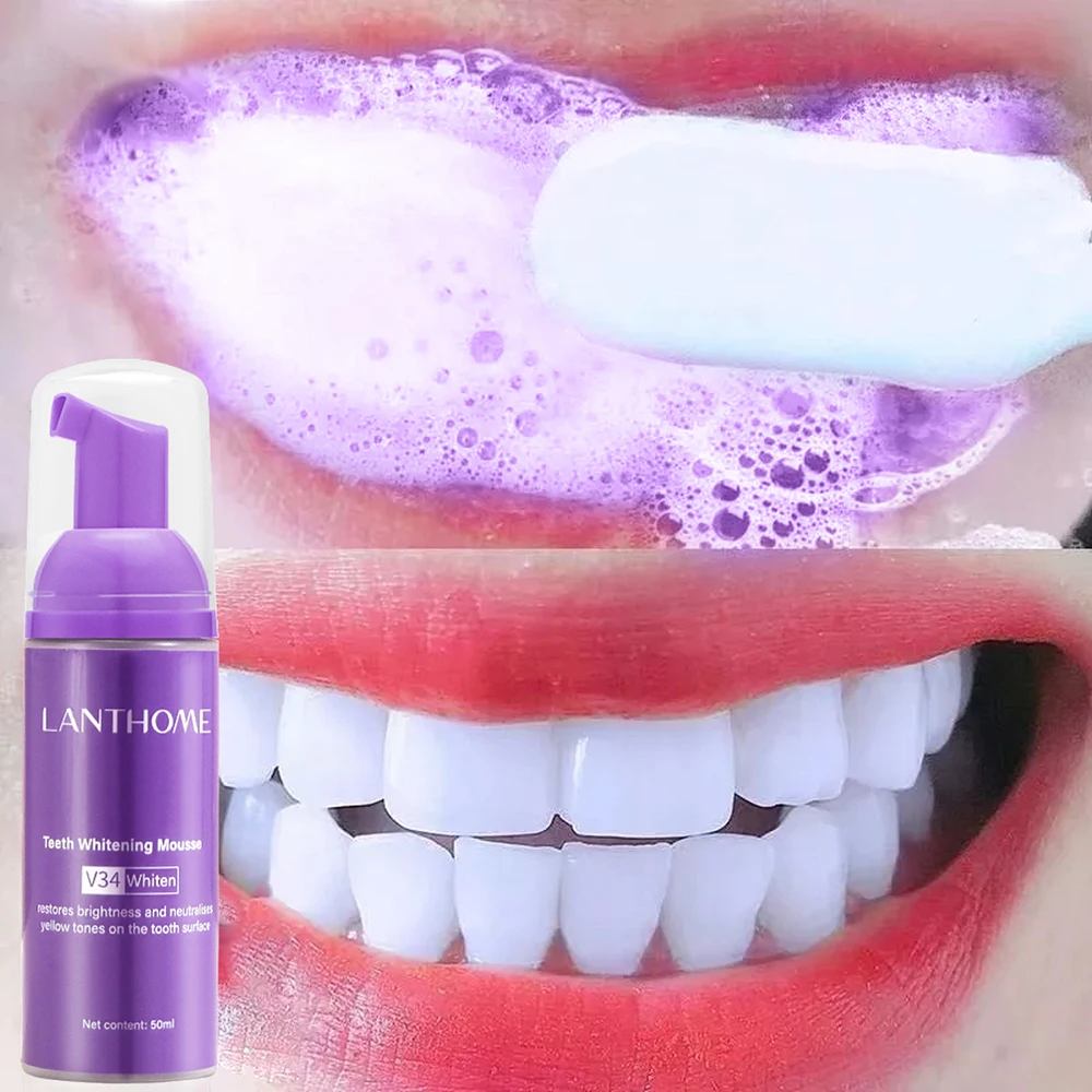 Mousse V34 Toothpaste Teeth Cl - Teeth Whitening Opalescence ulasan dan harga
